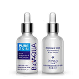 Anti Acne Treatment Moisturizing Essential Oil 30ml