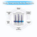 Anti-Acne Facial Cleanser Treatment