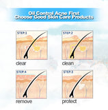 Anti-Acne Facial Cleanser Treatment